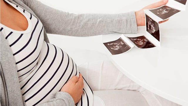 gty pregnant conjoined twins nt 110914 wg
