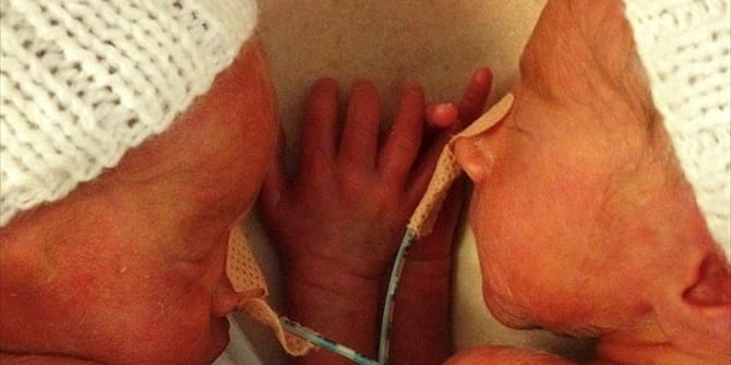 i sygkinitiki stigmi poy diduma enwnontai 10 meres meta apo prowro toketo