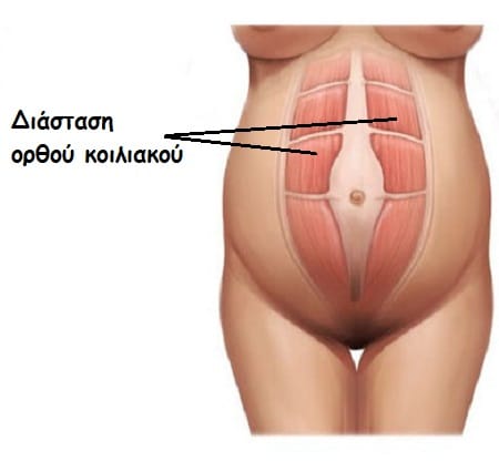 εικόνα 2