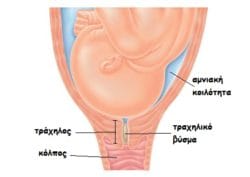 Κολπικά υγρά στην εγκυμοσύνη: Να ανησυχήσω; 1 A8DD758B 30F5 49A5 81AF A18CBD34666A