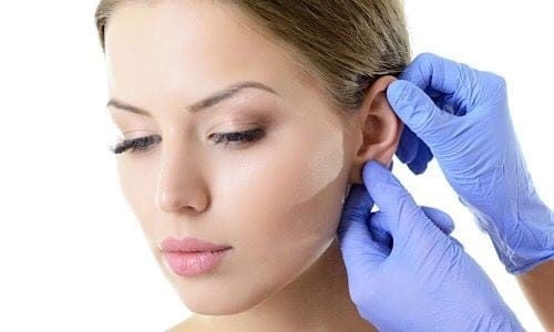 Όλα όσα θα θέλατε να ξέρετε για την ωτοπλαστική! 2 ωτοπλαστική