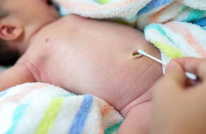 Νεογέννητα δίδυμα: Πώς πρέπει να φροντίζουμε τον αφαλό μέχρι να "πέσει"
