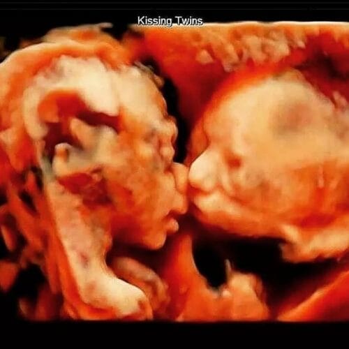 278767106 514790980089759 3029596322839174921 n