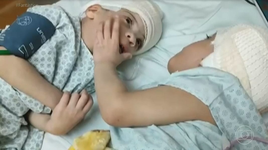 Επιτυχής διαχωρισμός δίδυμων σιαμαίων με ενωμένο εγκέφαλο - Η τρυφερή χειρονομία ύμνος στον δεσμό των διδύμων 5 DELTIO 21 2022 08 01 20.54.47 frame 81099 1068x601 1