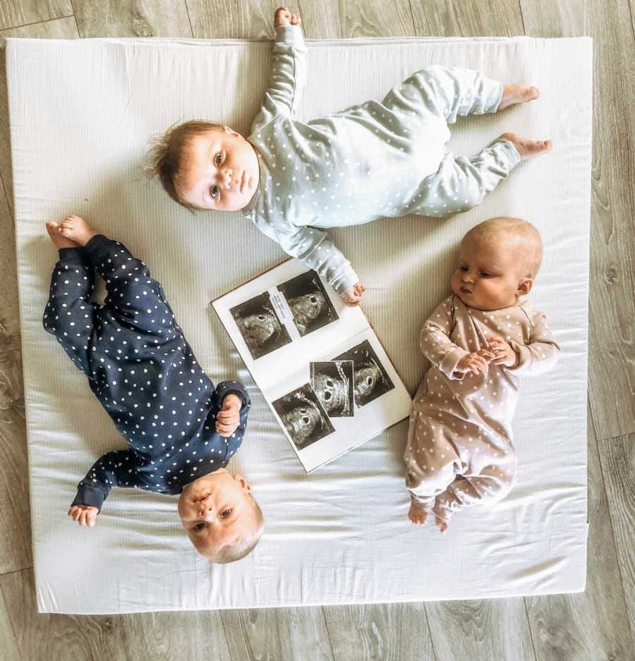 triplet triplets pregnancy abortion juditagota19 900x937 1