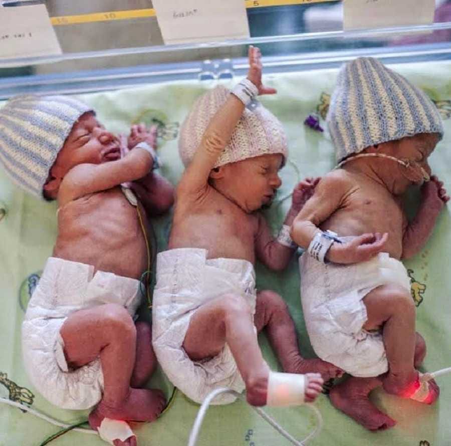 triplet triplets pregnancy abortion juditagota2 900x890 1