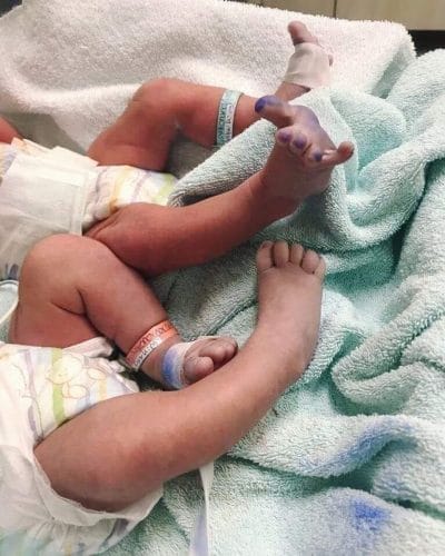 Δίδυμα σημαίνει διπλάσια φιλιά και αγάπη. Αξίζει τον διπλό κόπο! 2 34708193 1057689881072476 800342060115689472 n