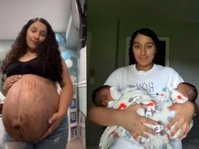 Μέλλουσα μαμά διδύμων γίνεται viral για την τεράστια κοιλιά της! 1 tiktokerka pozuje w 34 tygodniu ciazy jej brzuszek moze cie zaskoczyc 125722 4 3