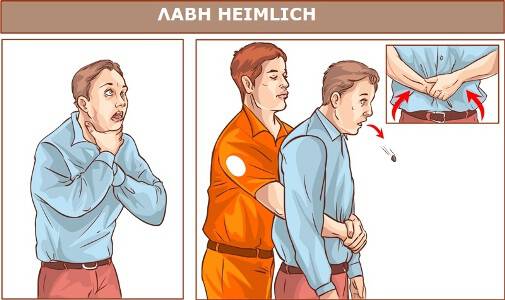 heimlich lavi