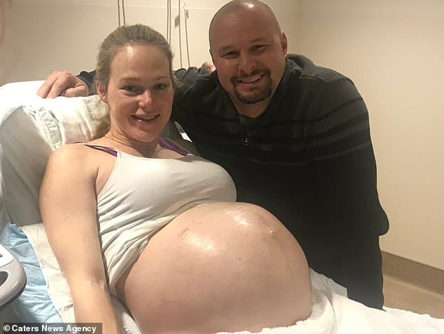 8013668 6544363 During the pregnancy she feared she would lose her babies as twi a 5 1546372733687