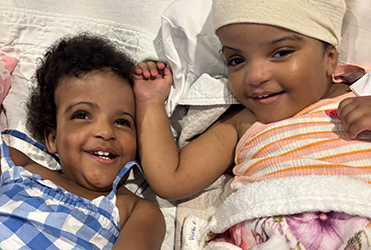 twins post surgery laughing and smiling